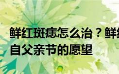 鲜红斑痣怎么治？鲜红斑痣会自己消除吗？来自父亲节的愿望