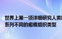 世界上第一项详细研究人类胰腺癌瘢痕组织的研究揭示了一系列不同的瘢痕组织类型