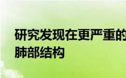 研究发现在更严重的情况下 流感病毒会重塑肺部结构