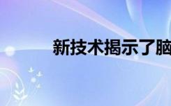 新技术揭示了脑细胞表观基因组