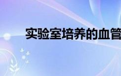 实验室培养的血管可以使透析更容易