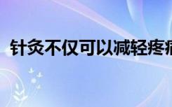 针灸不仅可以减轻疼痛还可以改善生活质量