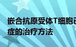 嵌合抗原受体T细胞已经改变了难治性血液癌症的治疗方法