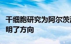 干细胞研究为阿尔茨海默氏病的新治疗方法指明了方向