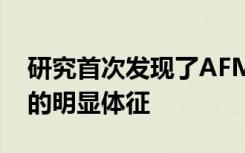 研究首次发现了AFM患者神经系统中肠病毒的明显体征