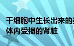 干细胞中生长出来的类器官可能会帮助修复人体内受损的肾脏