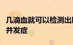 几滴血就可以检测出肝癌和危及生命的糖尿病并发症