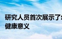 研究人员首次展示了幻觉对癫痫发作者的心理健康意义