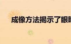 成像方法揭示了眼睛细胞中的长寿模式