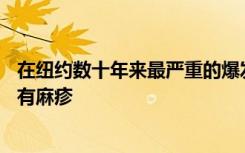 在纽约数十年来最严重的爆发中，一个人感染了另外21人患有麻疹