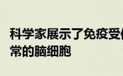 科学家展示了免疫受体如何清除死亡和功能异常的脑细胞