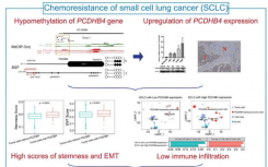 在小细胞肺癌中发现新的预后生物标志物
