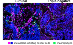科学家确定了阻止乳腺癌细胞扩散的潜在新免疫系统靶点